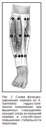 Qamoqxonadagi jinsiy aloqani tanlaganlar